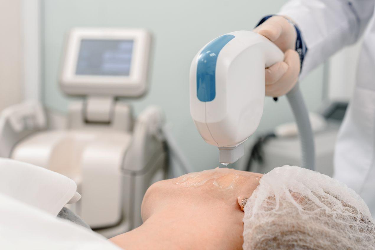 Medizinische Laserbehandlung einer Patientin – moderne Methode zum Couperose lasern durch Fachpersonal