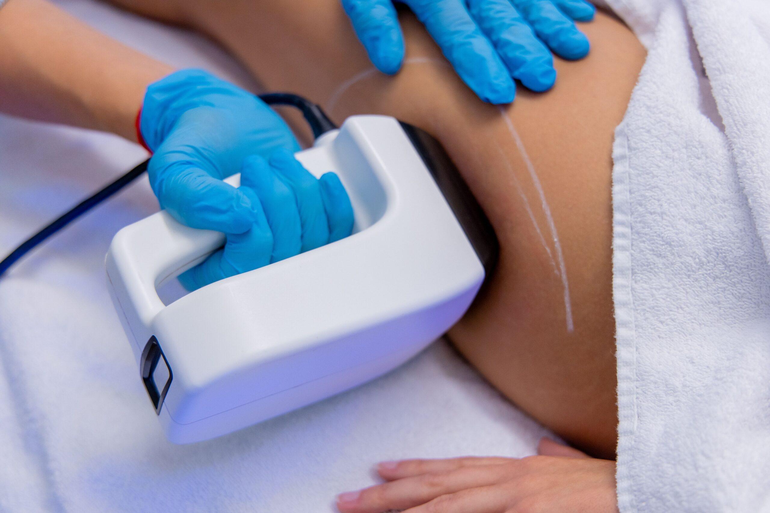 Laser Haarentfernung Frankfurt